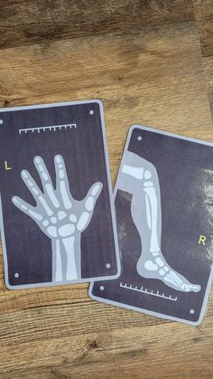 two stickers depicting hands and bones on a wooden surface