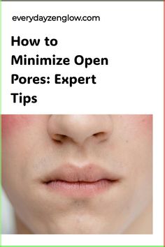 Struggling with open pores on your face? Learn how to minimize the appearance of open pores with these effective skincare tips. Say goodbye to visible pores and hello to smoother, clearer skin! Discover the best products and techniques to help reduce the look of open pores for a more refined complexion. Unlock the secrets to achieving a poreless-looking finish that will leave you feeling more confident in your skin. Whether you have oily, dry, or combination skin, there are solutions tailored ju Open Pores On Face, Big Pores, Homemade Facial Mask, Subcutaneous Tissue, Open Pores, Reduce Pores, Foaming Facial Cleanser, Clearer Skin