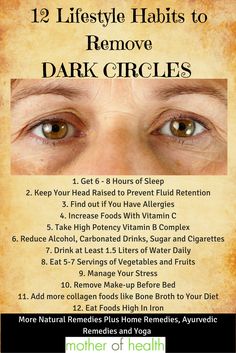 Eye Dark Circles Remedies Natural, Eyebags Remedy Under Eyes, Diy Eye Mask For Dark Circles, Coffee Eye Mask For Dark Circles, How To Avoid Dark Circles, How To Avoid Dark Circles Under Eyes, Home Remedy For Dark Circles Under Eyes Natural Treatments, Beauty Hacks Dark Circles, Dark Circles Under The Eyes