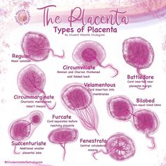 the different types of placanta in this diagram are labeled with names and pictures