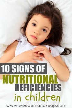 Child Nutrition, Nutritional Deficiencies, Childrens Health, Nutrition Education, Kids Nutrition, Health Info, Kids Health, Child Development