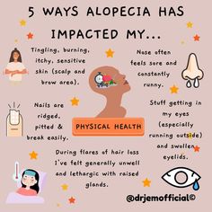 Alopecia Aesthetic, Physical Aesthetic, Hair Growing Tips, Hair Growing, Rpg Characters