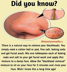 Natural Skin Care Remedies, Good Skin Tips, Skin Care Recipes, Natural Face, Glow Up Tips