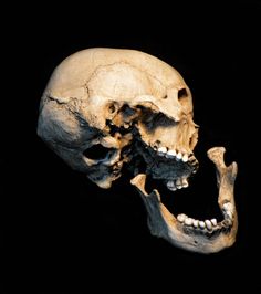 an image of a human skull with teeth