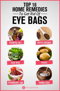 Top 16 Home Remedies To Get Rid Of Eye Bags Bags Under Eyes Remedy Diy, Eyes Bags Remedy, How To Get Rid Of Eye Bags Fast