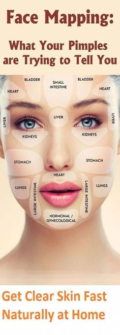 Gesicht Mapping, Face Map, Clear Skin Fast, Vaseline Beauty Tips, Body Routine, Mekap Mata, Face Mapping, Anti Aging Body, How To Remove Pimples