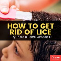 Cold Natural Remedies, How To Treat Lice, Lice Remedies, Remedy For Cold, Hair Lice, Lice Removal, Common Diseases, Holistic Health Remedies