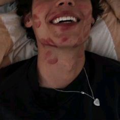 a man laying in bed with spots on his face