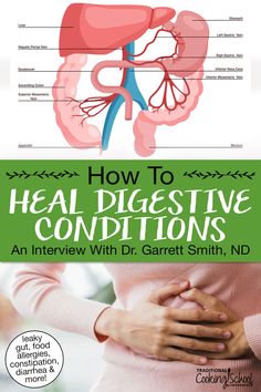 How To Fix Digestive Issues, Gut Dysbiosis, Ibs Natural Remedies, Ibs C, Gut Inflammation, Heal Leaky Gut, Bile Duct, Stomach Ulcers, Leaky Gut