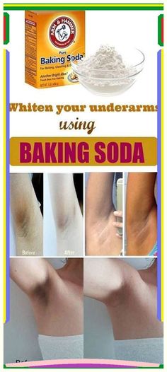 Supreme information. Jus Lemon, Baking Soda Shampoo, Skin Remedies, Grow Hair, Skin Treatments