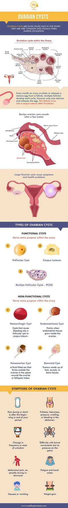 Ayurvedic treatment for Ovarian cyst provides permanent relief from cysts on the ovaries. Naturally dissolve ovary cyst with herbs, foods, yoga. Ovarian Dermoid Cysts, Bio Project, Hormone Imbalance Symptoms, Heavy Periods, Cycle Syncing, Natural Hormones