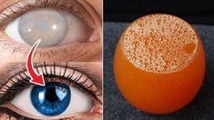 How To Improve Eye Sight Naturally, Eye Stye Remedies, Food For Eyes, Healthy Detox Cleanse, Eye Vision, Eye Problems, Biology Facts