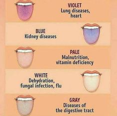 tongue color code Biology Facts, Neck Exercises, Back Pain Remedies, Tongue Health, Medical Facts, Medical School Inspiration, Nursing School Notes, Medical School Essentials, Medical Knowledge