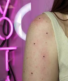 a woman with acne on her arm standing in front of a neon pink wall