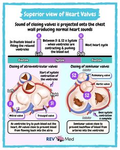 the heart valves and their functions are labeled in this diagram, which shows how it works