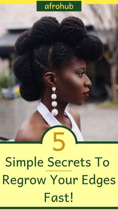 How to regrow your edges FAST!!! Edges Simple, Thinning Edges, Rid Of Dandruff, Dandruff Remedy, Getting Rid Of Dandruff