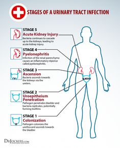 A urinary tract infection can be a serious problem for many individuals. Discover the 5 key phases to support urinary health. Bladder Health, Acute Kidney Injury, Kidney Pain, Healthy Remedies, Urinary Health, Natural Antibiotics, Kidney Health, Natural Treatments