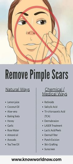 Pimple Scar Removal, Tea Tree Oil Skin, Pimple Scars, Skin Grafting, Basic Skin Care Routine, How To Remove Pimples, Perfect Skin Care Routine