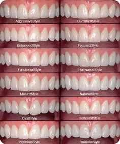 Cosmetic Dentistry Procedures, Beautiful Teeth, Perfect Teeth, Dental Art, Smile Teeth