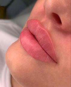 M Shape Lips, 1ml Lip Filler, Lip Goals, Juvederm Lips, Lip Plumping Balm, Lips Inspiration, Beauty Hacks Lips