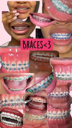 Cute Braces