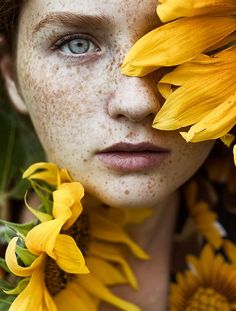 a woman with freckles on her face is surrounded by sunflowers