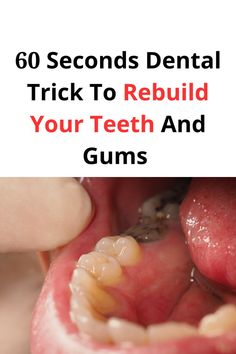 60 Second Dental Trick To Rebuild Your Teeth and Receding Gums Dental Health Care, Teeth Health, Receding Gums, Teeth Care, Healthy Smile, Oral Health Care, Tooth Decay, Oral Hygiene, Teeth Cleaning