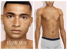 an image of a man with freckles on his face and chest before and after skin treatment