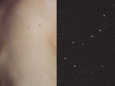 two different images of the same person's back and shoulder, one with spots on it