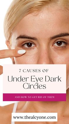 7 under eye dark circles causes Vitamins For Women, Combination Skin, Beauty Secrets, Natural Remedies