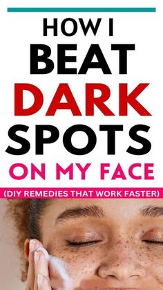 Face Dark Spots, Age Defying Skin Care, Dark Spots Remedies, Diy Anti Aging, Dark Spot Corrector, Skin Spots, Spots On Face, Diy Remedies