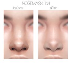 the nose before and after it has been corrected