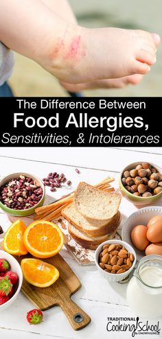 Do you have a food allergy? Wait, a food sensitivity? Or could it be a food intolerance? Do you know the difference between food allergies, sensitivities, & intolerances? Contrary to popular belief, the terms are not interchangeable and knowing which is which isn't as complicated as it seems. Learn the facts, plus the most reliable tests to find out which you may have! Allergies Remedies, Nutrition Careers, Anaphylactic Shock, Traditional Cooking, Nutrition Certification, Peanut Allergy