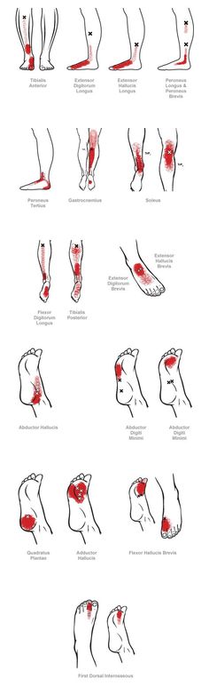 trigger point referral pain patterns for the ankle & foot Homemade Seasonings, Muscle Pain, Reflexology