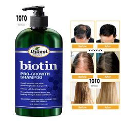 BEST SHAMPOO FOR THIN HAIR - Deeply Cleanses hair while promoting healthy hair growth. NATURAL HAIR LOSS SHAMPOO - Fortified, strengthening formula with Biotin, a water-soluble vitamin that's a part of the vitamin B family. Your body needs biotin to help convert certain nutrients into energy. BEST HAIR GROWTH SHAMPOO - Biotin plays an important role in the health of your hair, skin, and nails. A lack of Biotin can lead to hair loss.ttex... IDEAL SHAMPOO FOR THINNING HAIR AND HAIR LOSS MEN OR WOMEN - Strengthening formula leaves hair stronger, fuller and thicker while encouraging healthy hair growth. BEST HAIR THICKENING SHAMPOO: Our Pro-Growth Biotin Shampoo is sulfate free, paraben free, phtalate free. It works to keep your hair color vibrant while giving your hair manageability, softness Best Hair Growth Shampoo, Best Shampoo For Women, Best Hair Thickening Shampoo, Hair Color Vibrant, Hair Growth Natural Hair, Hair Thickening Shampoo, Best Shampoo, Biotin Shampoo, Shampoo For Thinning Hair