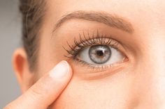 Crow’s feet are small wrinkles at the corners of your eyes, and can show up as early as your late teens. Learn how to reduce the appearance of crow's feet! Dry Eye Symptoms, Under Eye Wrinkles, Eye Wrinkle, Under Eye Bags, Deep Wrinkles, Chemical Peel, Dermal Fillers