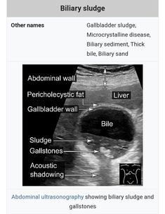 an x - ray shows the location of the utensils and their corresponding features