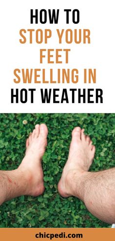 How To Stop Your Feet Swelling in Hot Weather