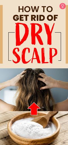 How To Get Rid Of Dry Scalp: If you don’t maintain proper hygiene by washing your hair and scalp regularly, you increase the risk of having a dry scalp. Other reasons could include medical conditions like psoriasis or eczema. In this post, we will share some natural remedies that can help you tackle a dry scalp at home. #haircare #haircaretips #dryscalp #remedies At Home Hair Mask For Dry Scalp, How To Oil Your Scalp, Diy Scalp Scrub For Dry Scalp, Severe Dry Scalp Remedies, Diy Scalp Oil For Dry Scalp, Diy Hair Mask For Dry Flaky Scalp, Scalp Hydration Diy, Diy Dry Scalp Mask, Dry Scalp Hair Mask Diy