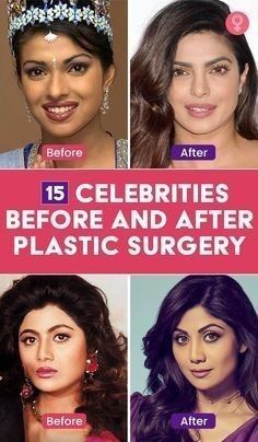 Nose Jobs, Celebrity Beauty Secrets, Makeup Mistakes