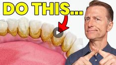 Dental Plaque, Teeth Health, Ketogenic Diet Recipes, Room With Plants, Health Diet, Health Remedies