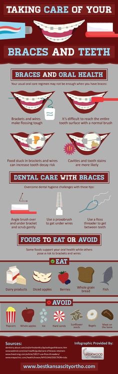 Wearing braces? If so, cleaning your teeth may be more difficult than it was without these orthodontic devices! Dental Facts, Teeth Braces, Teeth Care, Dental Hygiene