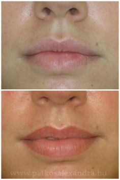 La Micropigmentación médica ó Maquillaje Permanente TRATAMIENTO DE MICROPIGMENTACIÓN EN LABIOS http://www.clinicaelenajimenez.com/medicina-estetica/micropigmentacion-medica/?gclid=CKb8kc_4ocwCFQoTGwodILMI3w Shading Lips, Micro Blading, Cosmetic Tattooing, Tattoo Makeup, Permanent Cosmetics