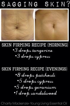 Home Remedies For Skin, Healing Essential Oils, Essential Oil Remedy, Makeup Tip, Oil Remedies, Yl Essential Oils, Living Essentials Oils