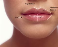 Bow Shaped Lips Filler, Bow Lips Shape, Lips With Cupids Bow, Soft Lip Filler, Vermillion Border Lip Filler, Where To Inject Lip Filler, Heavy Lower Lip Filler, Best Lip Shape, Lip Filler Cupids Bow