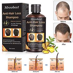 Anti-Hair Loss Shampoo, Hair Regrowth Shampoo, Natural Old Ginger Hair Care Shampoo Effective Solution for Hair Thinning & Breakage - Organic Hair Regrowth.Products for Men & Women Hair Regrowth Shampoo, Herbal Hair Growth, Longer Hair Growth, Fast Hair, Hair Growth Shampoo, Vitamins For Hair Growth, Shampoo Hair, Hair Thinning, Grow Hair Faster