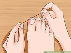 5 Ways to Relieve Ingrown Toe Nail Pain - wikiHow Toenail Pain, Physical Therapy Exercises, Ingrown Nail, Ingrown Toe Nail, Dental Floss, Homemade Remedies, Health And Beauty Tips, Body Health