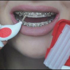 Teeth Aesthetic, Adult Braces