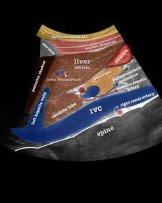 an image of the liver showing different stages