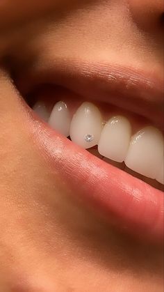 Tooth Diamond, Pretty Teeth, Grillz Teeth, Gum Inflammation, Veneers Teeth, Diamond Teeth, Loose Tooth, Perfect Teeth, Tooth Gem